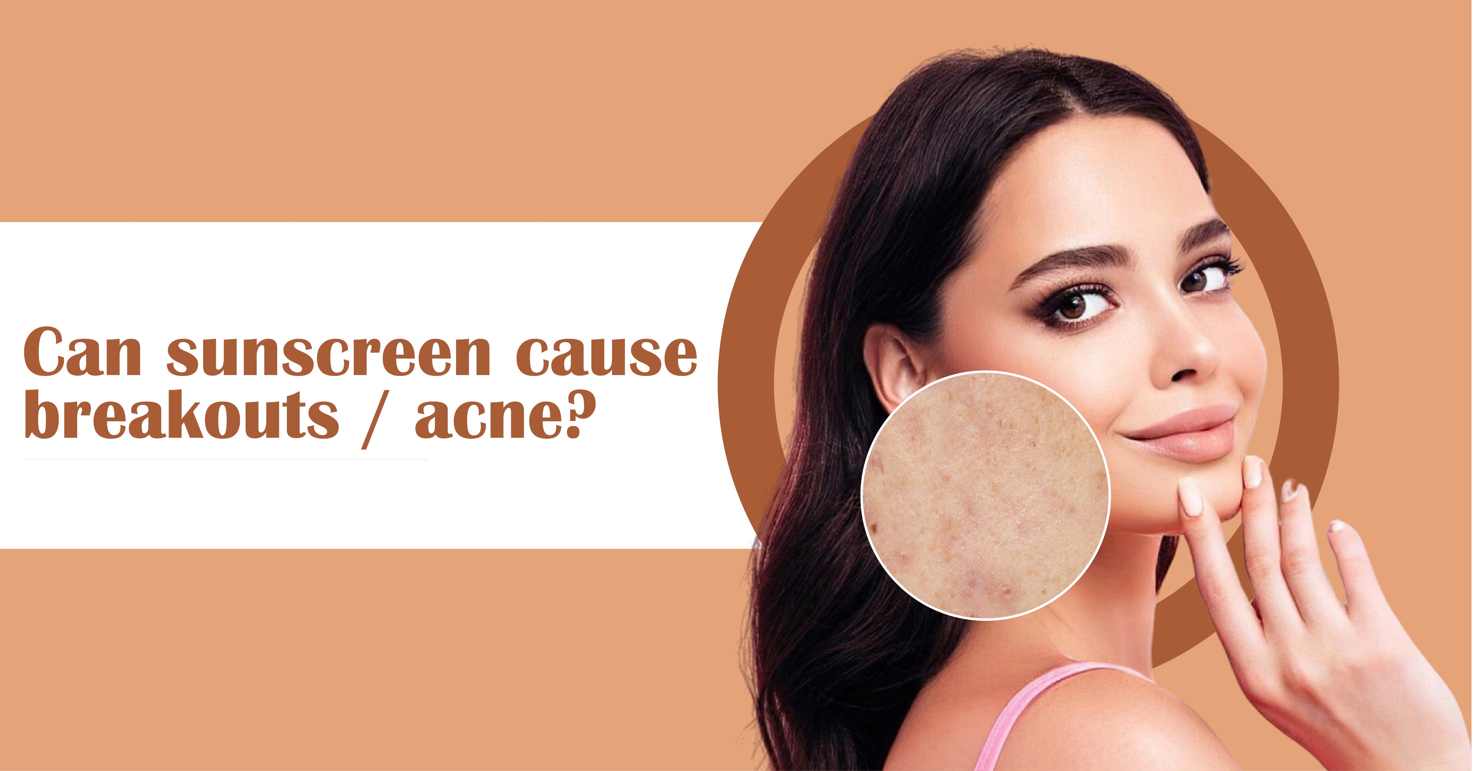 Sunscreen Cause Breakouts