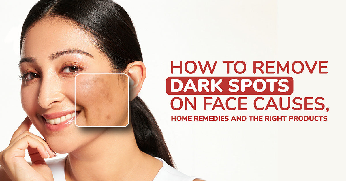 How to Remove Dark Spots on Face