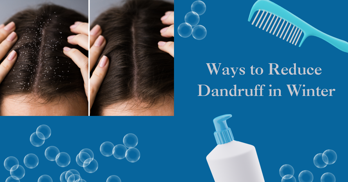 Ways to Reduce Dandruff in Winter