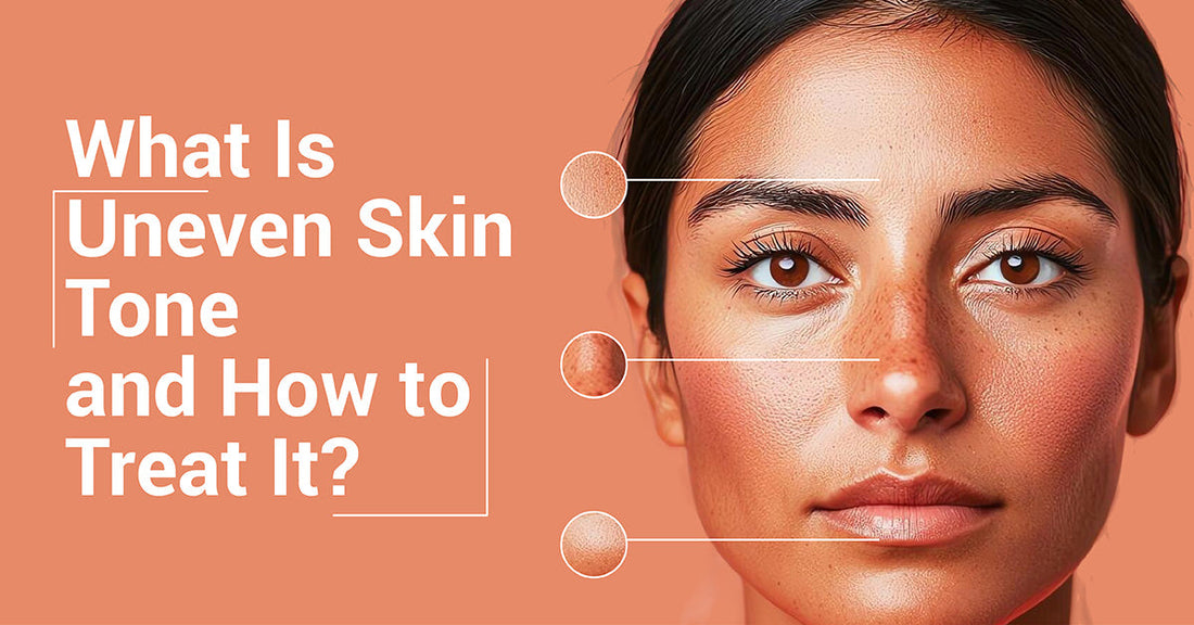 What Causes Uneven Skin Tone and How to Fix It