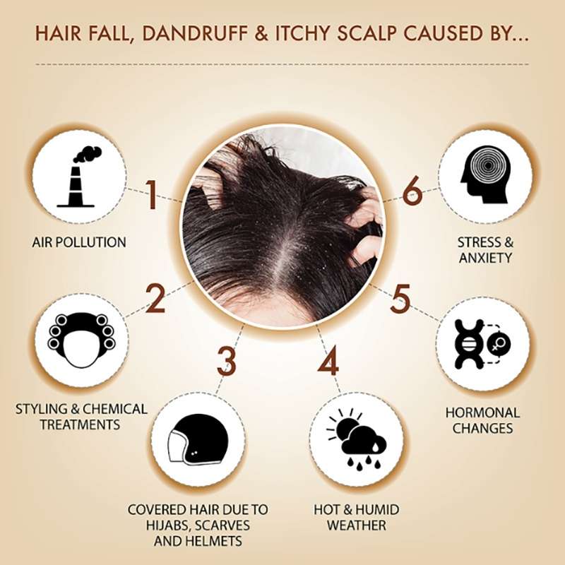 Causes Of Hair Fall, Dandruff And Itchy Scalp