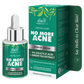 Iba Advanced Activs Crystal Clear No More Acne Power Serum with 2% Salicylic Acid